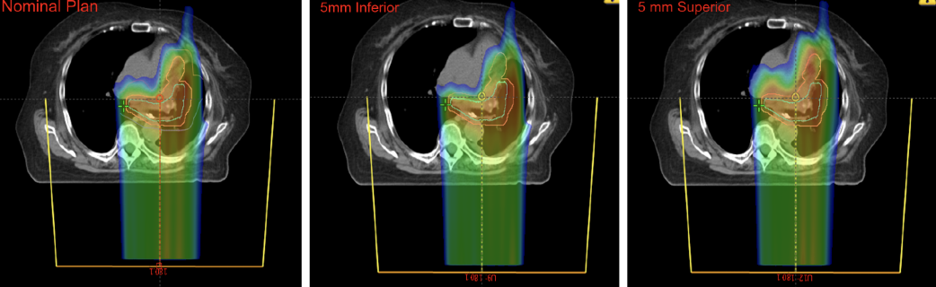 Experimental prompt gamma scatter classification and reorientation for proton beam image reconstruction